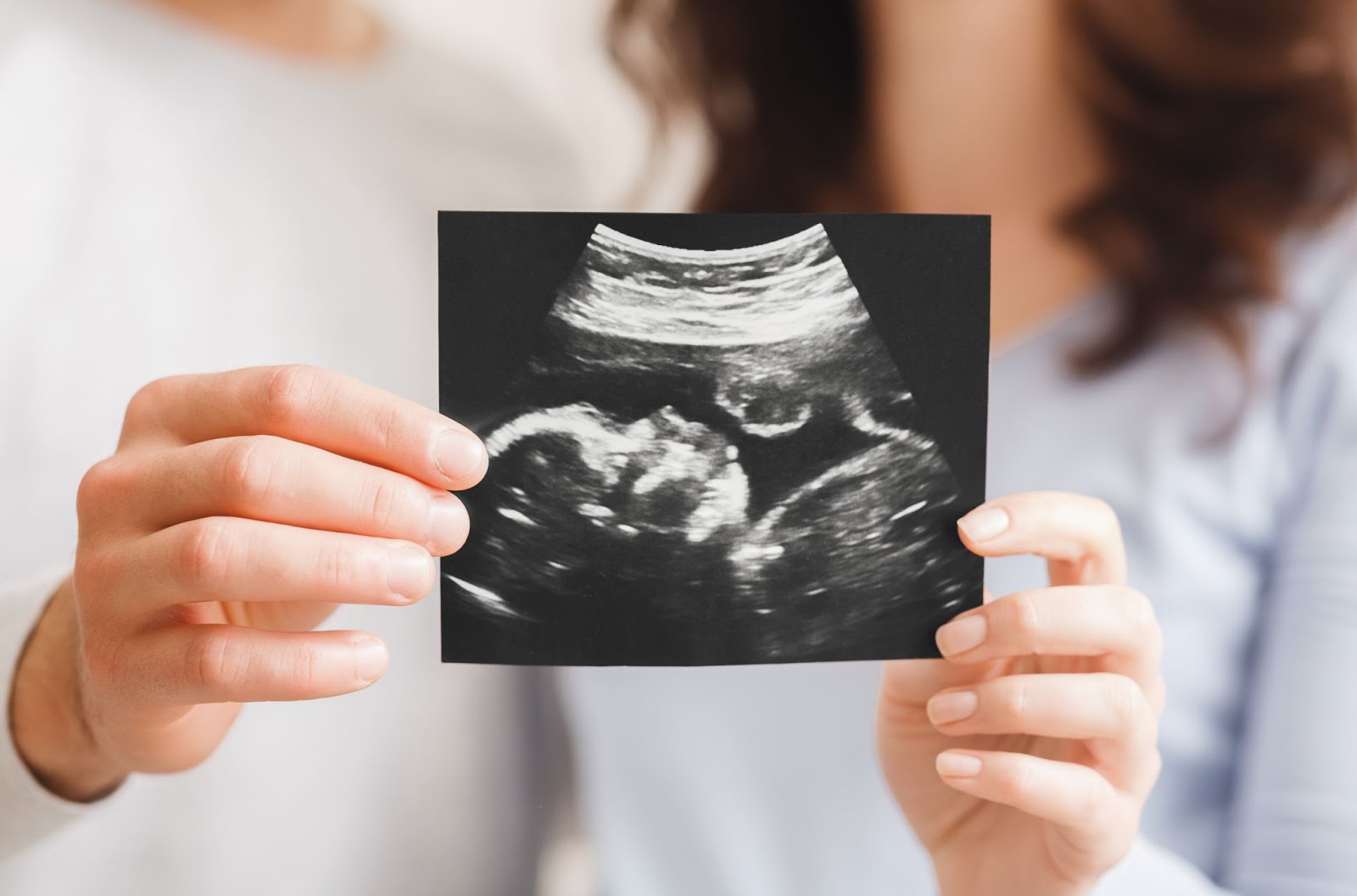 Couple holding a 12 week pregnant ultrasound.